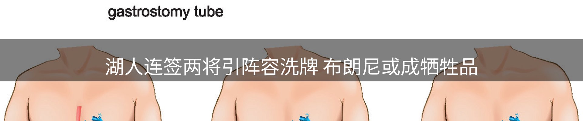 新闻资讯